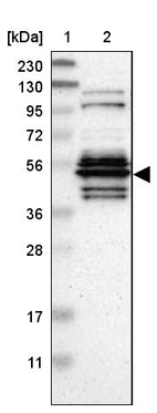 Lane 1: Marker [kDa] 230, 130, 95, 72, 56, 36, 28, 17, 11_br/_Lane 2: Human cell line RT-4