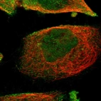 Immunofluorescent staining of human cell line A-431 shows localization to nucleoplasm & plasma membrane.