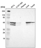 Western blot analysis in human cell line RT-4, human cell line U-251 MG, human plasma, human liver tissue and human tonsil tissue.