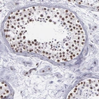Immunohistochemical staining of human testis shows moderate to strong nuclear positivity in cells in seminiferous ducts.