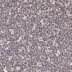 Immunohistochemical staining of human tonsil shows nuclear positivity in lymphoid cells.