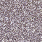 Anti-NKAP Antibody