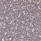 Immunohistochemical staining of human tonsil shows nuclear positivity in lymphoid cells.
