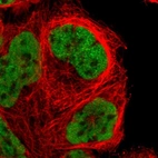 Immunofluorescent staining of human cell line A-431 shows localization to nucleoplasm.