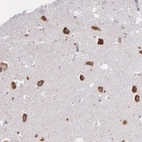 Anti-CTAGE5 Antibody