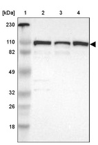 Lane 1: Marker [kDa] 230, 110, 82, 49, 32, 26, 18_br/_Lane 2: Human cell line RT-4_br/_Lane 3: Human cell line U-251MG sp_br/_Lane 4: Human cell line A-431
