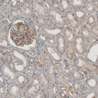 Anti-THSD7A Antibody