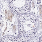 Immunohistochemical staining of human testis shows weak membranous positivity in Leydig cells.