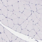 Immunohistochemical staining of human skeletal muscle shows no positivity in myocytes as expected.