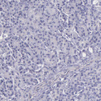 Immunohistochemical staining of human pancreas shows no positivity in exocrine glandular cells as expected.