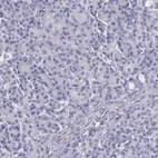 Immunohistochemical staining of human pancreas shows no positivity in exocrine glandular cells as expected.