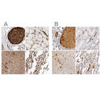 Anti-C4BPA Antibody