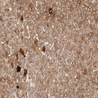 Anti-C4BPA Antibody