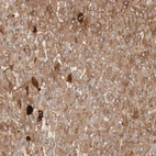 Immunohistochemical staining of human liver shows strong cytoplasmic positivity in hepatocytes.