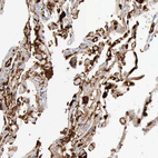 Immunohistochemical staining of human lung shows strong cytoplasmic positivity in macrophages.