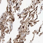 Immunohistochemical staining of human lung shows strong cytoplasmic positivity in macrophages.