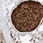 Immunohistochemical staining of human colon shows strong positivity in plasma.