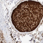Immunohistochemical staining of human colon shows strong positivity in plasma.