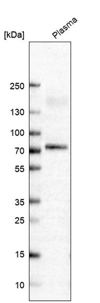 Western blot analysis in human plasma.
