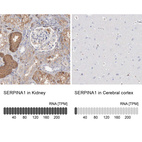 Anti-SERPINA1 Antibody