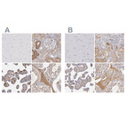 Anti-SERPINA1 Antibody