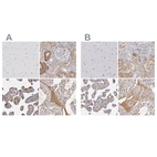 Immunohistochemical staining of human cerebral cortex, kidney, placenta and testis using Anti-SERPINA1 antibody HPA000927 (A) shows similar protein distribution across tissues to independent antibody HPA001292 (B).