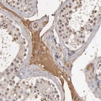 Immunohistochemical staining of human testis shows moderate positivity in plasma.