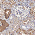 Anti-SERPINA1 Antibody