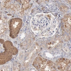 Immunohistochemical staining of human kidney shows moderate positivity in plasma.