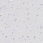 Immunohistochemical staining of human cerebral cortex shows no positivity in neurons as expected.