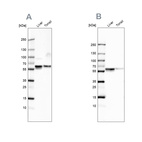 Western blot analysis using Anti-SERPINA1 antibody HPA000927 (A) shows similar pattern to independent antibody HPA001292 (B).