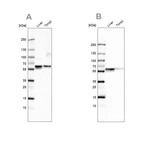 Western blot analysis using Anti-SERPINA1 antibody HPA000927 (A) shows similar pattern to independent antibody HPA001292 (B).