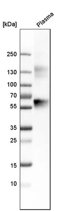 Western blot analysis in human plasma.