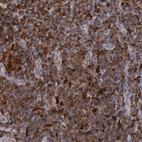 Anti-STAT1 Antibody