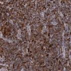 Immunohistochemical staining of human lymph node shows strong cytoplasmic and membranous positivity in germinal center cells and non-germinal center cells.