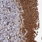 Immunohistochemical staining of human urinary bladder shows strong cytoplasmic and membranous positivity in urothelial cells.