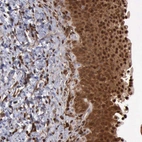 Immunohistochemical staining of human urinary bladder shows strong cytoplasmic and membranous positivity in urothelial cells.