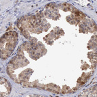 Anti-STAT1 Antibody