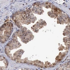 Immunohistochemical staining of human prostate shows moderate cytoplasmic and membranous positivity in glandular cells.