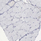Immunohistochemical staining of human skeletal muscle shows very weak positivity in myocytes.