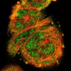 Immunofluorescent staining of human cell line A-431 shows localization to nucleoplasm & cytosol.