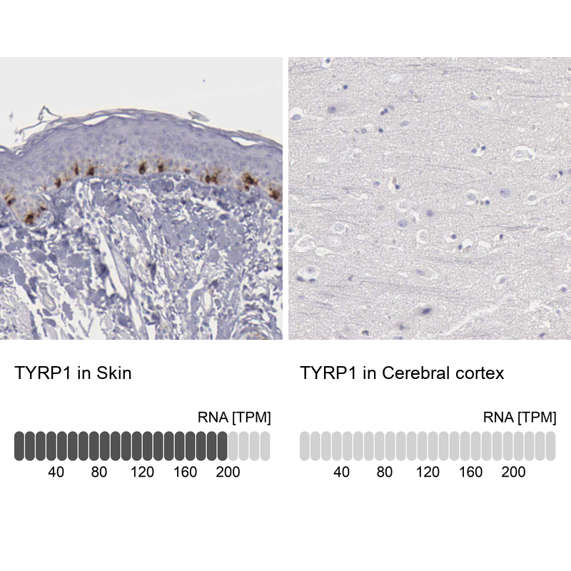 Anti-TYRP1 Antibody