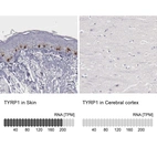 Anti-TYRP1 Antibody
