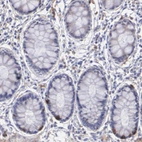 Immunohistochemical staining of human rectum shows moderate to strong cytoplasmic positivity in a subset of glandular cells and cells in stroma.