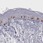 Immunohistochemical staining of human skin shows moderate to strong cytoplasmic positivity in melanocytes.