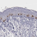 Immunohistochemical staining of human skin shows moderate to strong cytoplasmic positivity in melanocytes.