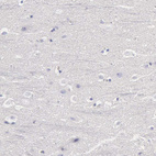 Immunohistochemical staining of human cerebral cortex shows no positivity in neurons as expected.