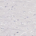 Immunohistochemical staining of human cerebral cortex shows no positivity in neurons as expected.