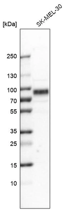 Western blot analysis in human cell line SK-MEL-30.