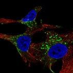Immunofluorescent staining of human cell line SK-MEL-30 shows localization to vesicles.